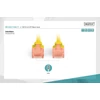 Kép 4/6 - DIGITUS CAT6 U/UTP LSZH 1m sárga patch kábel