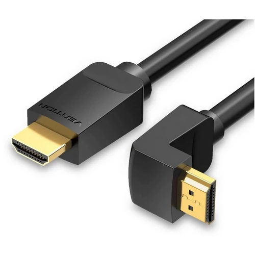 KÁBEL HDMI, ( 270 Fok, jobb), 1,5m, Vention